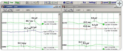 WebShare | Live intraoperative monitoring